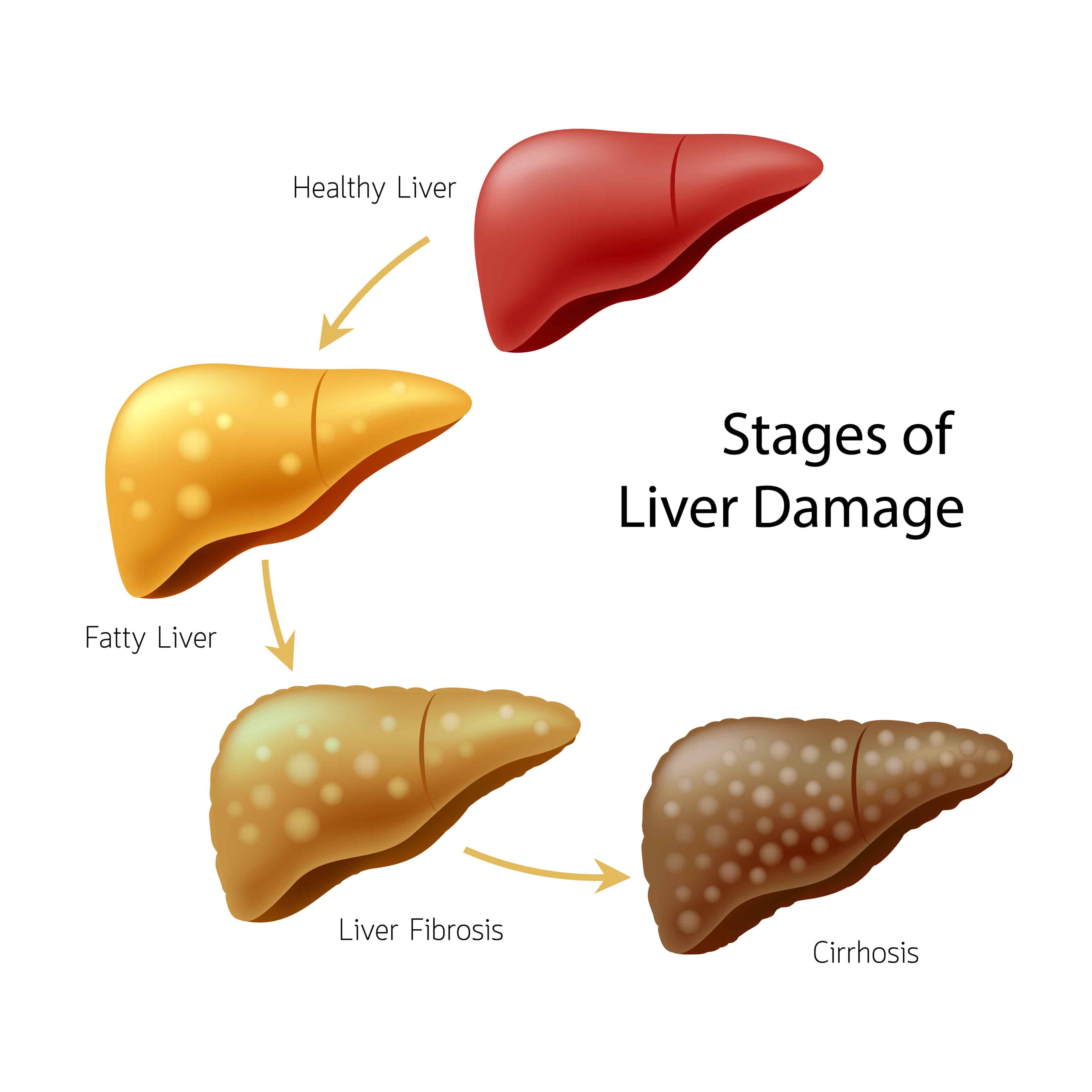 How To Reduce Your Risk For Liver Disease • Nonahood News
